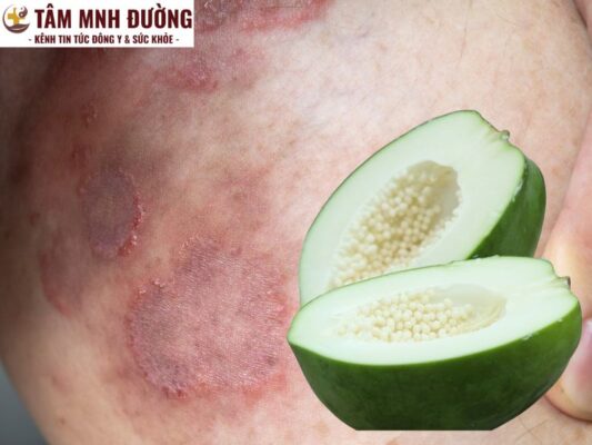 Đu đủ xanh điều trị hắc lào